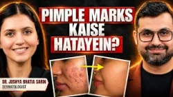 Clear Skin Kaise Milegi? Pimple Kaise Hatayein? | Dr. Jushya Bhatia Sarin
