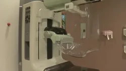High Resolution: Why women should start annual mammograms by age 40
